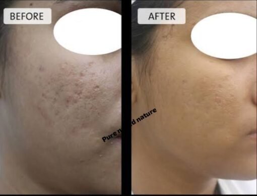 Ubtan Kasturi Face Pack - Image 2